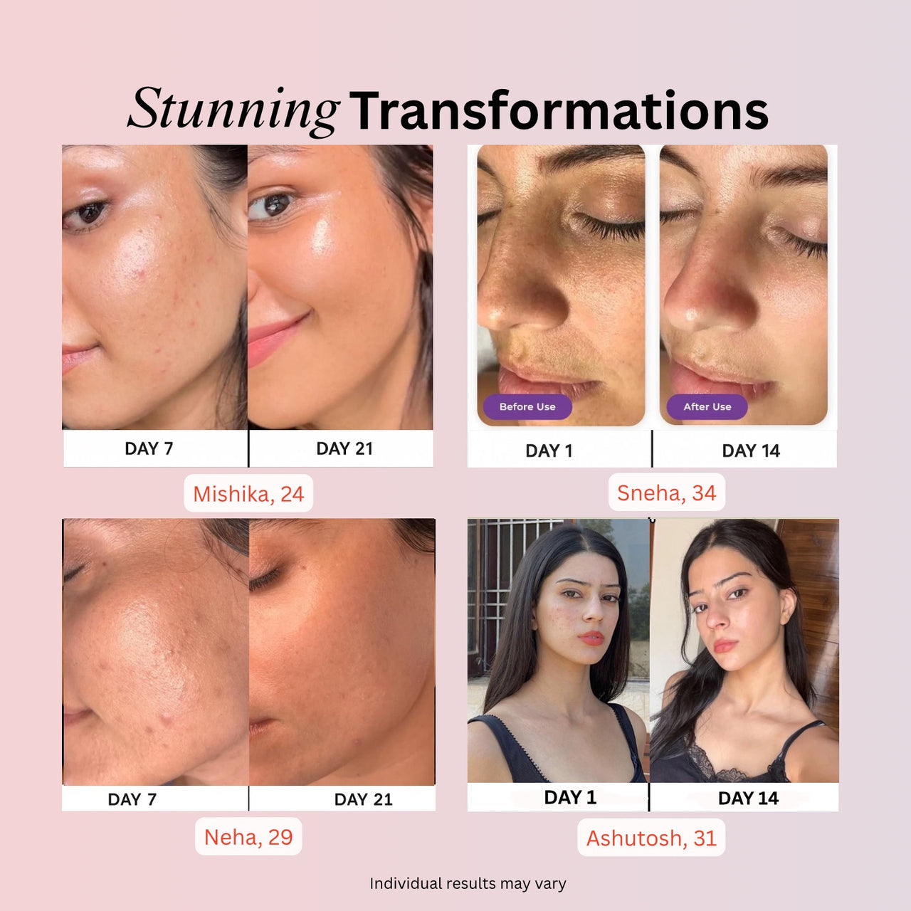 4-in-1 Skincare Wand