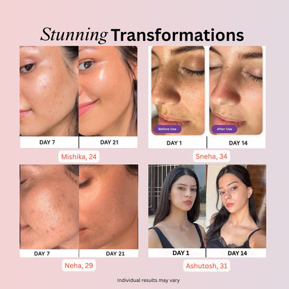 4-in-1 Skincare Wand