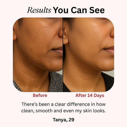 4-in-1 Skincare Wand
