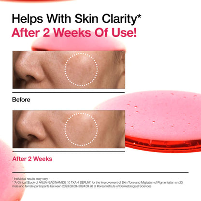 Anua Niacinamide 10% + TXA 4% Serum